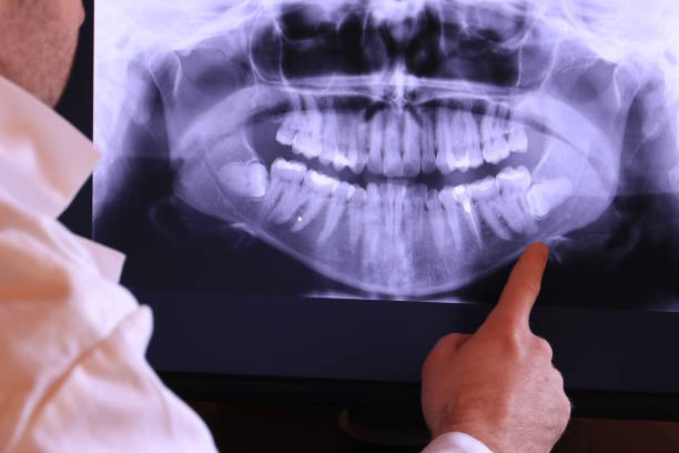 Emergency Dentist Open Today in NY