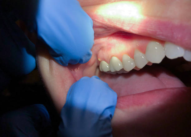 Best Cracked Tooth Emergency Dentist  in Franklin Square, NY